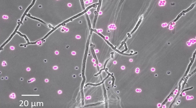 Novel bacterial pH bioreporters allow to assess in vivo the pH of the fungal hyphosphere at the micrometer scale  
(© Bijing Xiong/UFZ) https://rdcu.be/cC5HQ